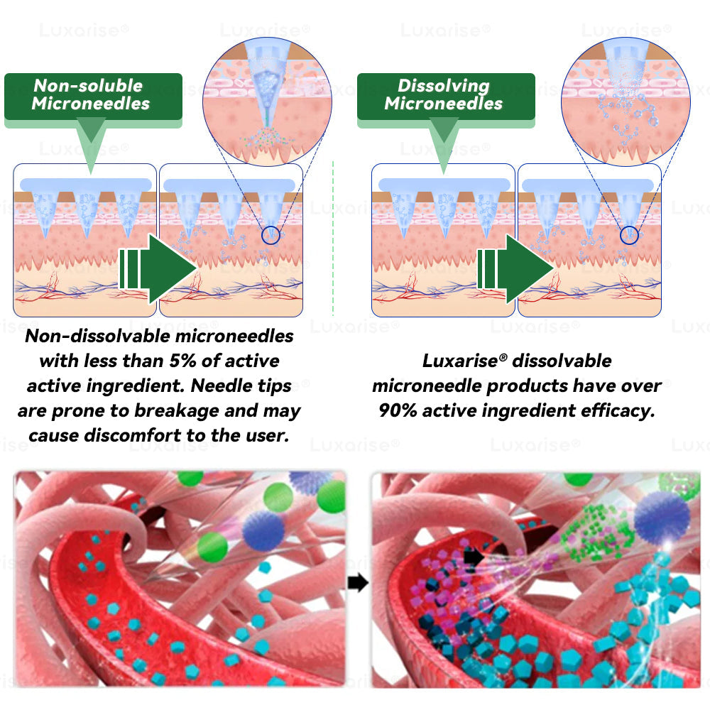 Once Daily, Visible Changes in 7 Days 🎟️ 𝑳𝒖𝒙𝒂𝒓𝒊𝒔𝒆® 𝑴𝒐𝒓𝒊𝒏𝒈𝒂 & 𝑩𝒆𝒓𝒃𝒆𝒓𝒊𝒏𝒆 10-𝑰𝑵-1 𝑨𝒅𝒗𝒂𝒏𝒄𝒆𝒅 𝑵𝒂𝒏𝒐 𝑴𝒊𝒄𝒓𝒐𝒏𝒆𝒆𝒅𝒍𝒆 𝑷𝒂𝒕𝒄𝒉 𝐎𝐛𝐞𝐬𝐢𝐭𝐲, 𝐃𝐢𝐚𝐛𝐞𝐭𝐞𝐬, 𝐒𝐥𝐞𝐞𝐩 𝐀𝐩𝐧𝐞𝐚, 𝐀𝐧𝐝 𝐉𝐨𝐢𝐧𝐭 𝐈𝐬𝐬𝐮𝐞𝐬 📙