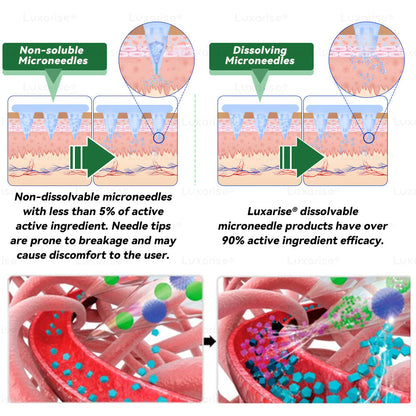 Once Daily, Visible Changes in 7 Days 🎟️ 𝑳𝒖𝒙𝒂𝒓𝒊𝒔𝒆® 𝑴𝒐𝒓𝒊𝒏𝒈𝒂 & 𝑩𝒆𝒓𝒃𝒆𝒓𝒊𝒏𝒆 10-𝑰𝑵-1 𝑨𝒅𝒗𝒂𝒏𝒄𝒆𝒅 𝑵𝒂𝒏𝒐 𝑴𝒊𝒄𝒓𝒐𝒏𝒆𝒆𝒅𝒍𝒆 𝑷𝒂𝒕𝒄𝒉 𝐎𝐛𝐞𝐬𝐢𝐭𝐲, 𝐃𝐢𝐚𝐛𝐞𝐭𝐞𝐬, 𝐒𝐥𝐞𝐞𝐩 𝐀𝐩𝐧𝐞𝐚, 𝐀𝐧𝐝 𝐉𝐨𝐢𝐧𝐭 𝐈𝐬𝐬𝐮𝐞𝐬 📙